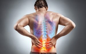 Backache Backache